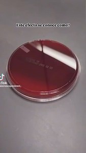. . . . Proteus mirabilis swarming behavior is characterized by the development of concentric rings of growth that are formed as cyclic events of swarmer cell differentiation, swarming migration, and cellular differentiation are repeated during colony translocation across a surface #microbiology #microbiologist #bacteriology #microbiologylab #microbe #explorepage #agarart | Medical Microbiologist