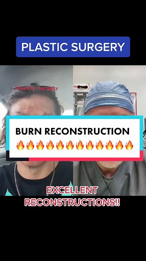 Burn Reconstruction: Skin Graft Procedure Explained