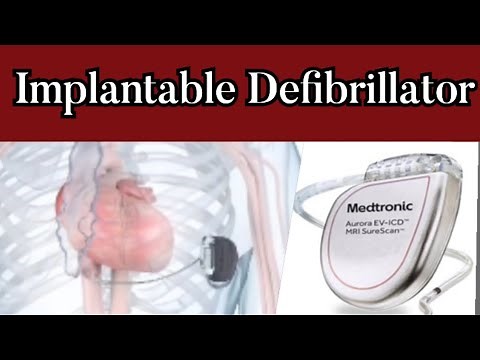 Aurora Extravascular Implantable Cardioverter Defibrillator (EV-ICD) System by Medtronic inc