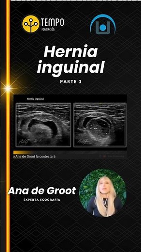 Hernia inguinal y ecografía parte 3 con Ana de Groot