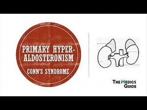 Primary Hyperaldosteronism (Conn's Syndrome)