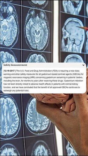 MRI with Contrast Gadolinium - FDA's Stance on It
