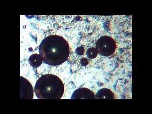 ¿Cómo se ven las Bacterias y Flemas a través del microscopio?