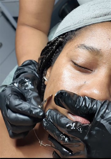 A good dermaplane with a mix of hydrated and unclogging unwanted pores #facial #facials #facialtreatment #skintreatments #glowingskin