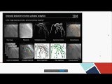 Usage of Artificial Intelligence in Cardiovascular Surgery • Video • MEDtube.net