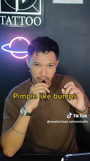 Understanding Tattoo Pimple Reactions and Treatment