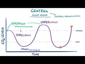 Sleep apnea causes, symptoms, diagnosis, treatment, pathology