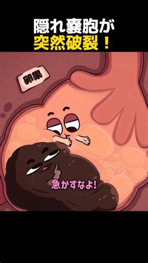 隠れ嚢胞が突然破裂！