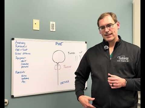 Prostatic Artery Embolization PAE