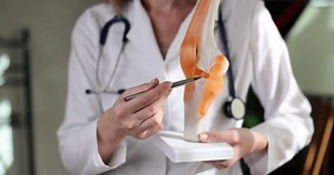 Doctor holds in hands anatomical model of human knee joint in clinic