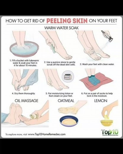 How to get rid peeling skin on your feet.
