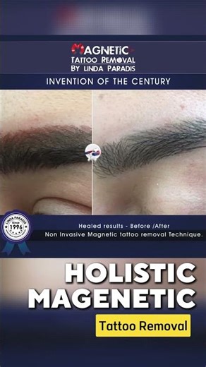Holistic Magnetic Tattoo Removal: Stunning Before & After Results