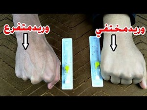 تعلم تركيب الكانيولا في الاوردة المتفرعة وتركيب الكانيولا ف الاوردة المخفية_iv cannulation procedure