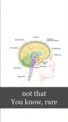 Why a Pituitary Gland Enlarges (It’s Not Diet)