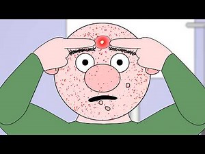 Zits : Animated Music Video