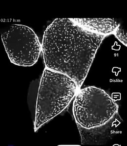 Actin is one of the most important molecules in your body It’s a protein that gives cells shape, lets them move, and allows them to divide. Your muscles contract because of actin. Your immune cells chase bacteria because of actin. Your cells split in two because of actin. In this video, you’re watching actin do what it does best. The cell deliberately takes apart its internal actin network to divide, then rapidly rebuilds the same complex structure afterward. No blueprint. No pause. Just molecul