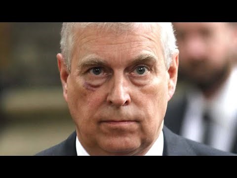 Prince Andrew's Complete Transformation