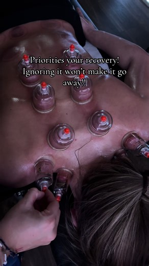 @Jessica came in with back pain! Carried out sports massage and finished off the session with cupping! #cuppingtherapy #sportsmassage #sports #recovery #fyp