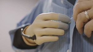 A Prosthetic Hand That Can Feel
