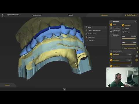 Dentsply Sirona InLab Splint 22 - gefräst McX5 und gedruckt mit Anycubic - so geht´s...