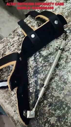 “Turnbuckle Dynamic Splint! Contracture Correction Magic 😱🔥”