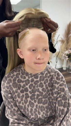 #alopecia #nuolawigs | Wig Hair