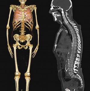 Doylestown Hospital uses advanced CT technology  to increase patient safety