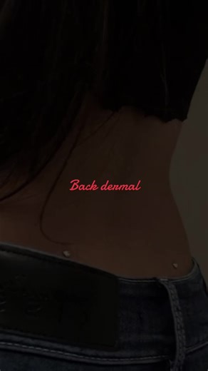 Understanding Back Dermal Piercing: A Complete Guide