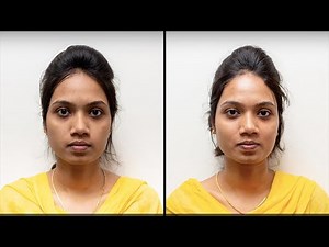 HydraFacial Treatment (Before & After) Chennai for Younger Skin