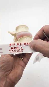 Facet Joint Spacing Demonstration