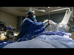 Stroke Prevention Device at Mercy Hospital St. Louis: Alternative to Blood Thinners