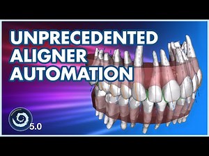 Unprecedented AI Automation Streamlines Aligner Case Design!