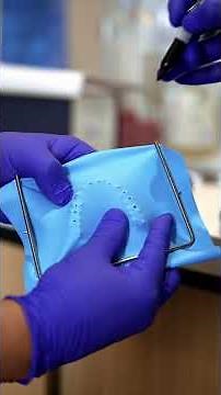 Composite Veneer Injection Moulding Technique: Step by Step