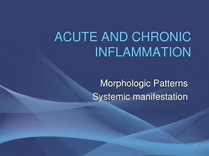 ACUTE AND CHRONIC INFLAMMATION - SlideServe