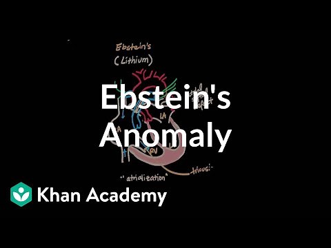 Ebstein's anomaly | Circulatory System and Disease | NCLEX-RN | Khan Academy