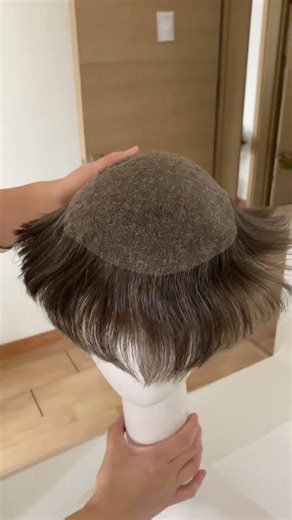 hair replacement system