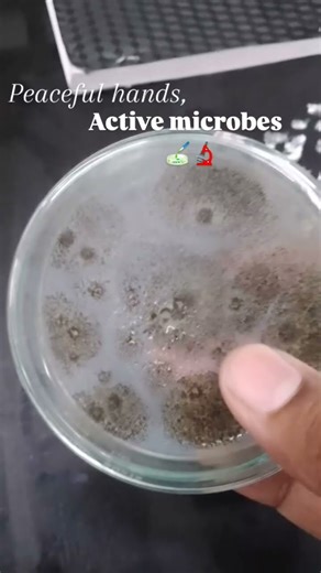 Just quiet lab days .....🧫🔬