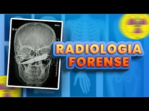 O QUE É RADIOLOGIA FORENSE | Radiologando