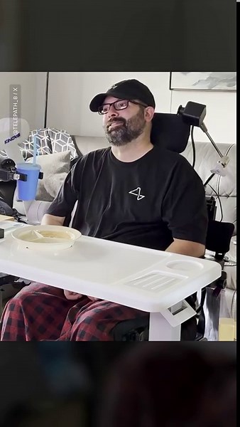 Neuralink patient controls robot arm using only his hand movements