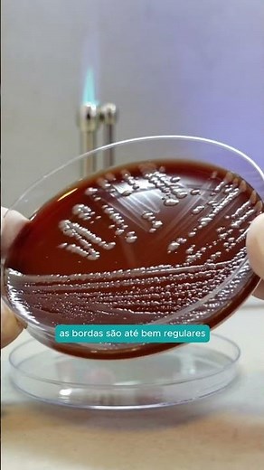 Tips for sowing and identification in clinical microbiology | Microlab Educacional #shorts