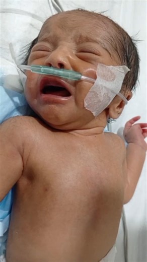 Newborn Baby Grunting 😟 | Normal or Warning Sign? NICU Explained