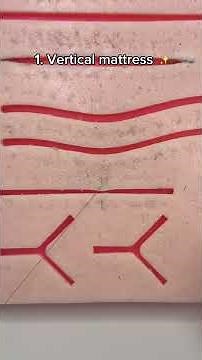 Vertical vs Horizontal Mattress Sutures