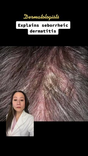 Seborrheic Dermatitis Treatment: Shampoo and Skincare Tips