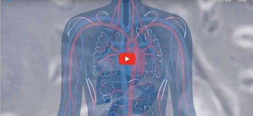 Video: Non-Small Cell Lung Cancer Questions Answered