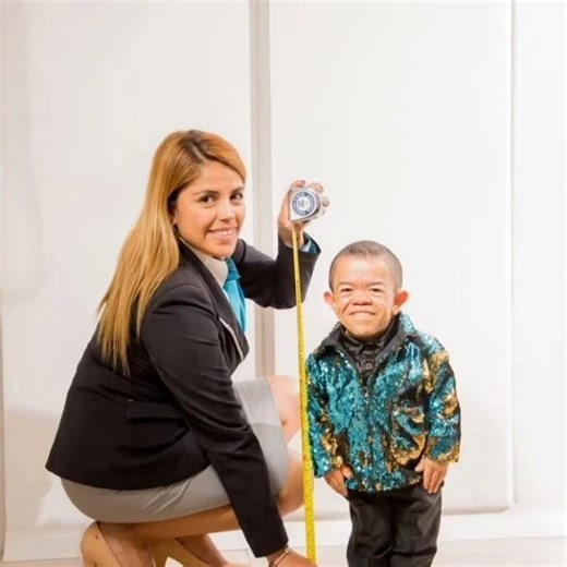 Top 5 Smallest People in the World 🌍😱 | Guinness World Records#shorts