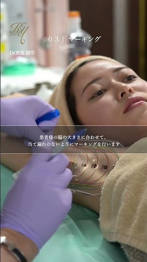 切らないワキ汗治療 #ミラドライ #超音波 #美容整形 #プチ整形 #共立美容外科 #汗腺