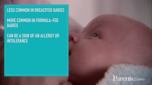 14K views · 37 reactions | Constipation can be a sign of a food intolerance. Here's what to look out for: | Parents | Facebook