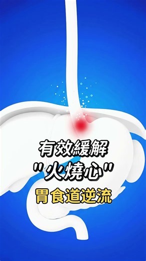 胃食道逆流怎麼辦？教你「2大核心原則」，輕鬆緩解火燒心！