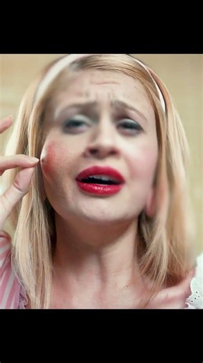 🫘 GIANT PIMPLE THAT WON’T POP! | Then a HAIR GROWS… AND MOVES! 😱