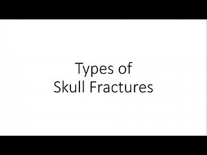 Types of Skull Fractures - Forensic Medicine (FMT)